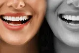 Tạm biệt vết ố: Những phương pháp làm trắng răng tự nhiên mà không làm hỏng men răng