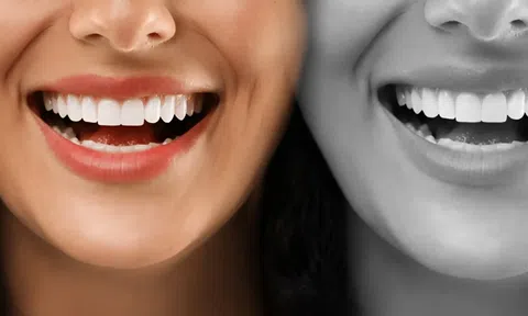 Tạm biệt vết ố: Những phương pháp làm trắng răng tự nhiên mà không làm hỏng men răng